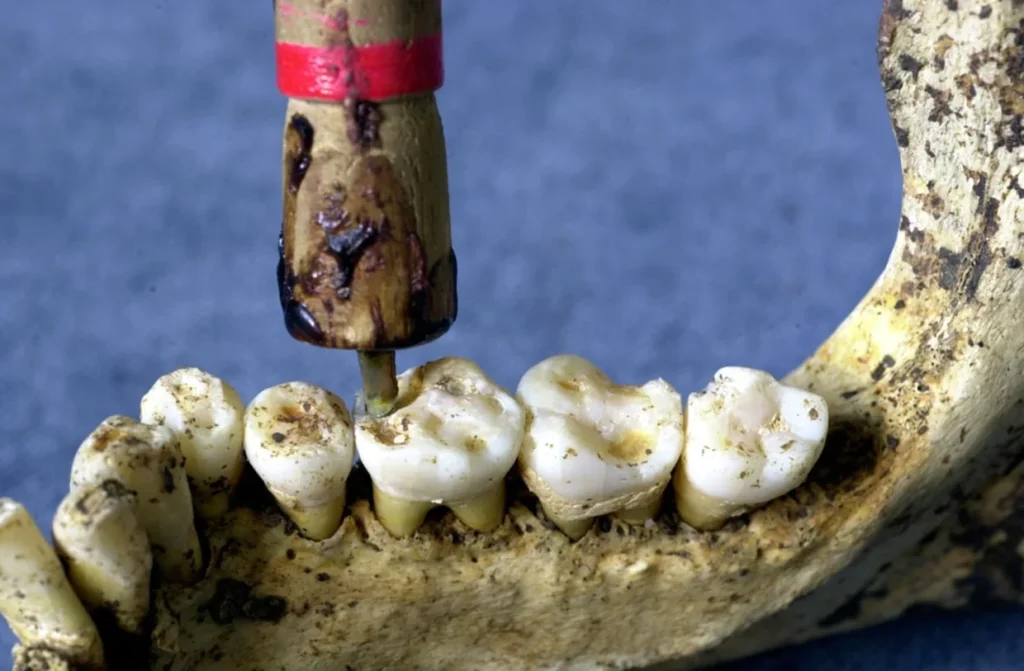 060405 Prehistoric Dentistry Vlg9a