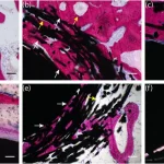 Histological Appearance Of The Implant Bone Interface For 100X Magnification A Newly