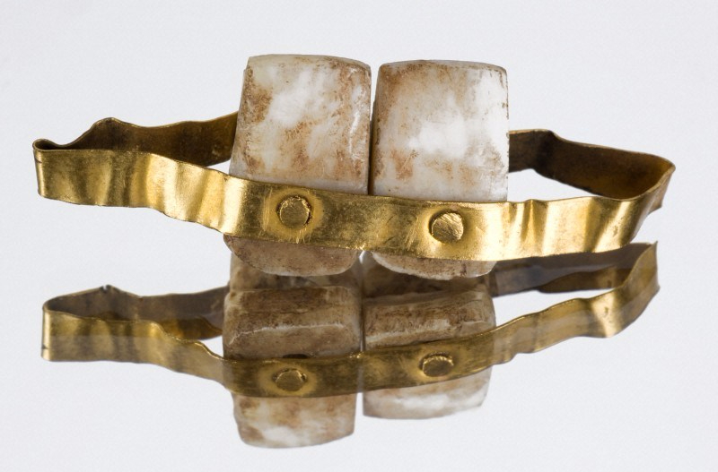 Etruscan Denture Wellcome Collection E1507738513271