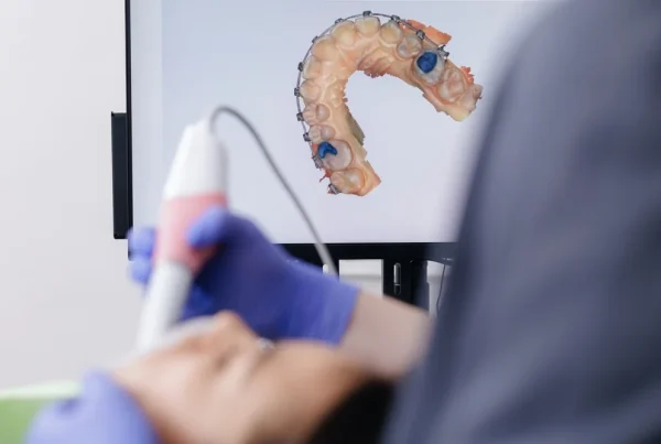 Procesul de scanare dentara cu ajutorul unui bont de scanare